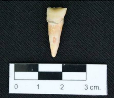 ฟันตัดด้านบน (upper incisor) ของคน (ธวัลรัตน์ ชัยนราพิพัฒน์, 2557: 71)<br>